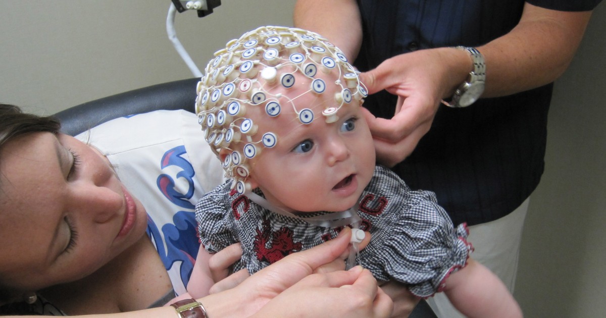 Эпилепсия до года. ЭЭГ мониторинг головного мозга. ЭЭГ головного мозга ребенку. ЭЭГ мониторинг сна у детей. ЭЭГ мониторинг головного мозга у детей.